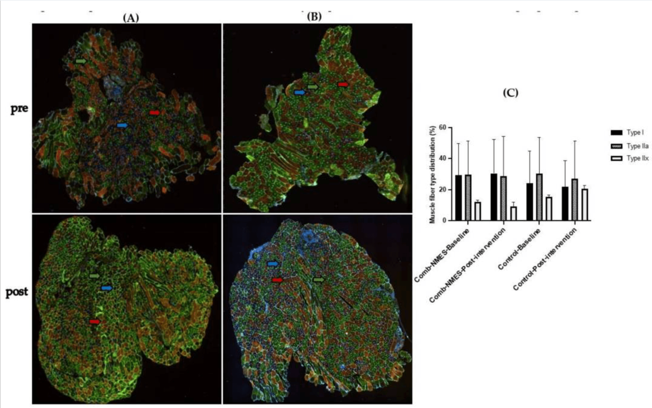 The Effect of Lower Limb Combined Neuromuscular Electrical Stimulation on Skeletal Muscle Signaling for Glucose Utilization, Myofiber Distribution, and Metabolic Function after Spinal Cord Injury